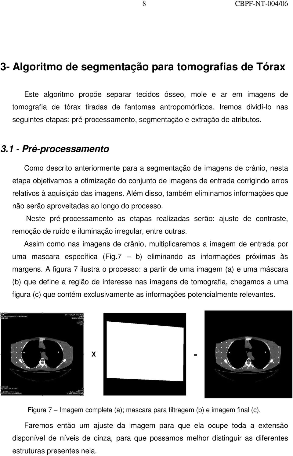 1 - Pré-processamento Como descrito anteriormente para a segmentação de imagens de crânio, nesta etapa objetivamos a otimização do conjunto de imagens de entrada corrigindo erros relativos à