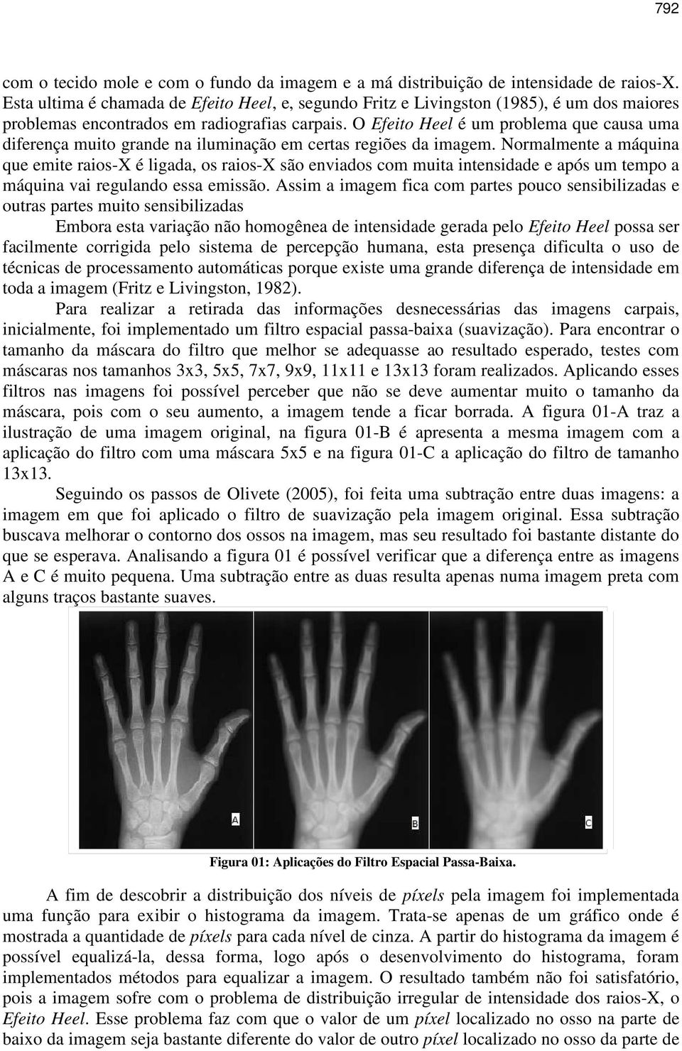 O Efeito Heel é um problema que causa uma diferença muito grande na iluminação em certas regiões da imagem.