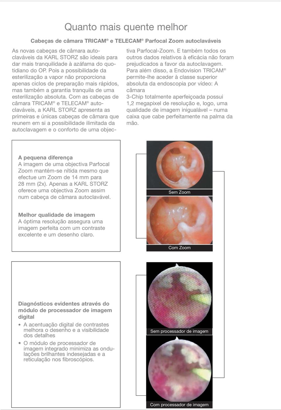 Com as cabeças de câmara TRICAM e TELECAM autoclaváveis, a KARL STORZ apresenta as primeiras e únicas cabe ças de câmara que reunem em si a possibilidade ilimita da da auto cla vagem e o conforto de