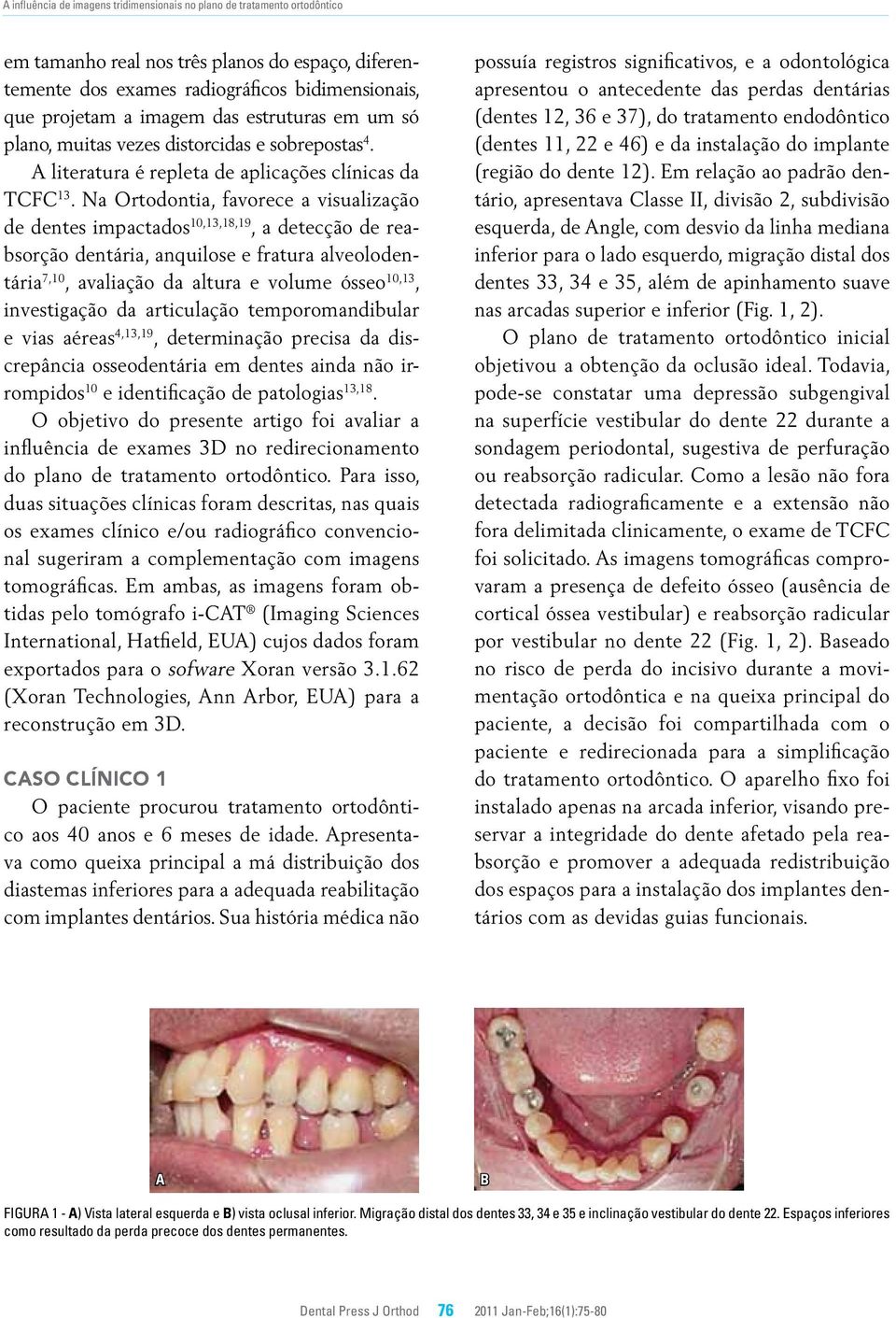 Na Ortodontia, favorece a visualização de dentes impactados 10,13,18,19, a detecção de reabsorção dentária, anquilose e fratura alveolodentária 7,10, avaliação da altura e volume ósseo 10,13,