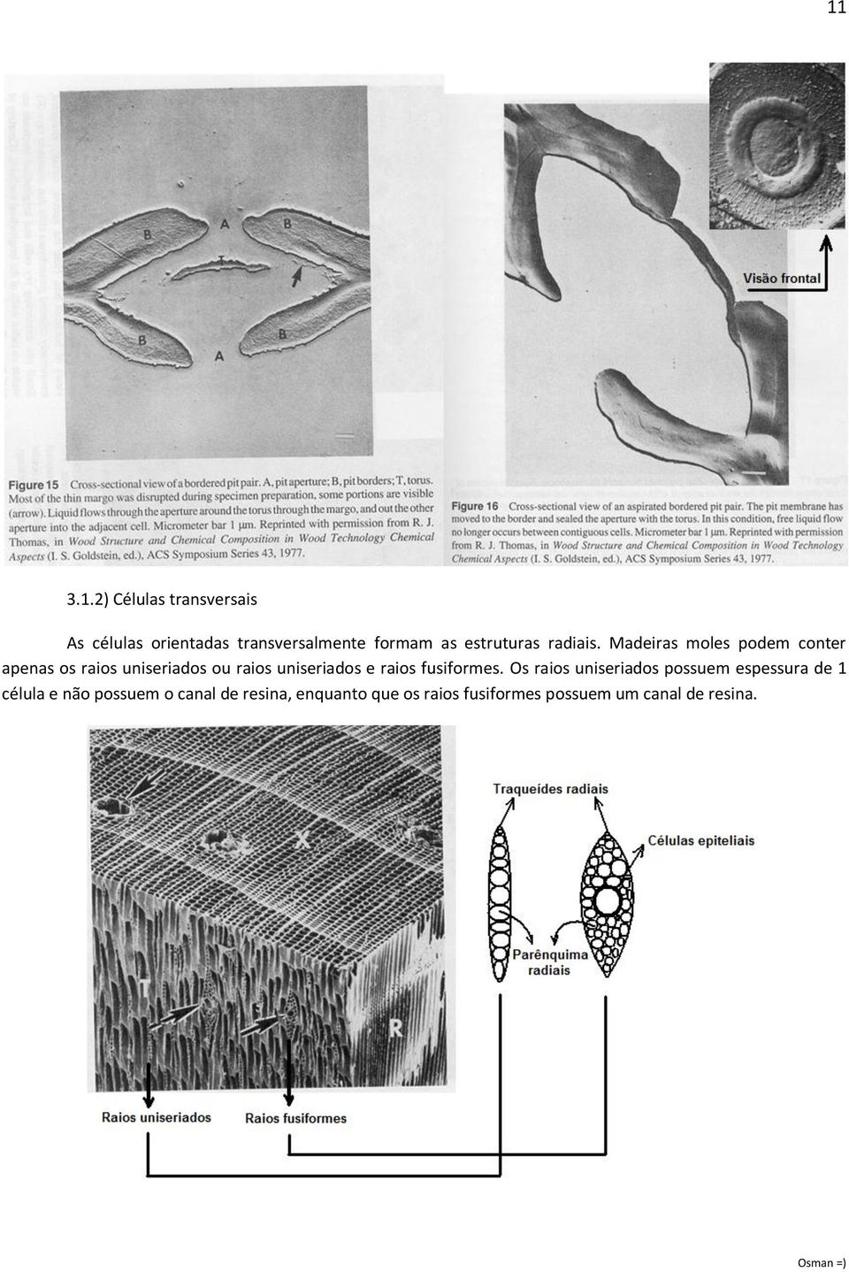 Madeiras moles podem conter apenas os raios uniseriados ou raios uniseriados e raios