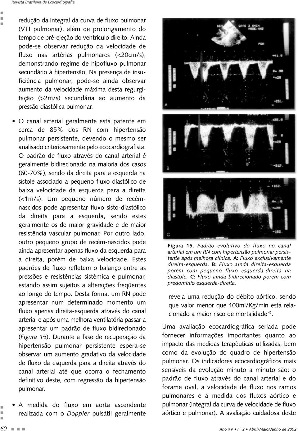 Na presença de insuficiência pulmonar, pode-se ainda observar aumento da velocidade máxima desta regurgitação (>2m/s) secundária ao aumento da pressão diastólica pulmonar.