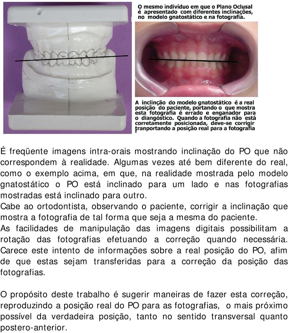 outro. Cabe ao ortodontista, observando o paciente, corrigir a inclinação que mostra a fotografia de tal forma que seja a mesma do paciente.