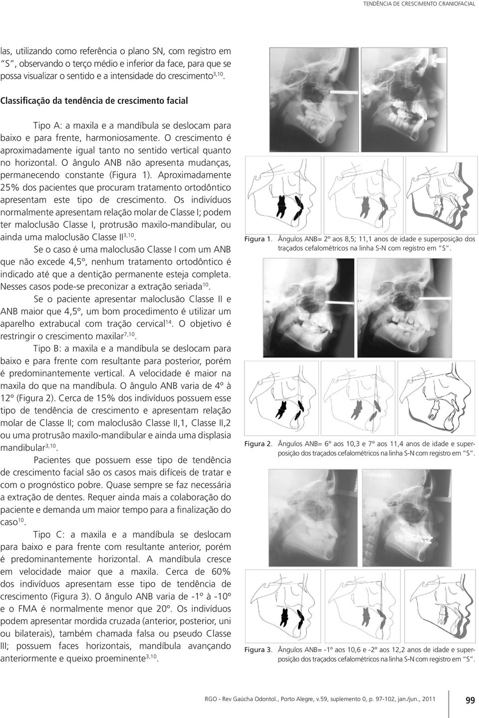 O crescimento é aproximadamente igual tanto no sentido vertical quanto no horizontal. O ângulo ANB não apresenta mudanças, permanecendo constante (Figura 1).