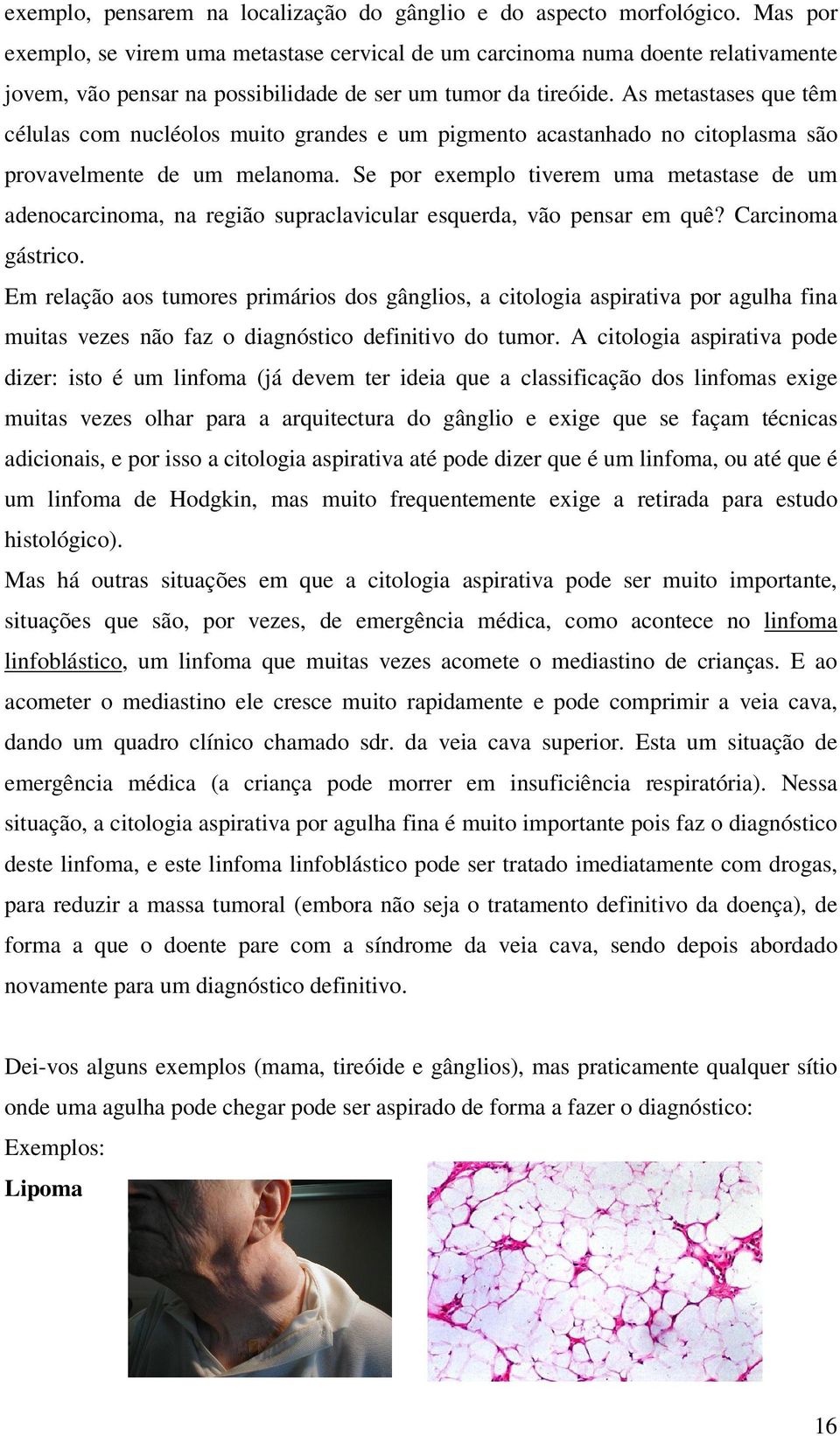 As metastases que têm células com nucléolos muito grandes e um pigmento acastanhado no citoplasma são provavelmente de um melanoma.