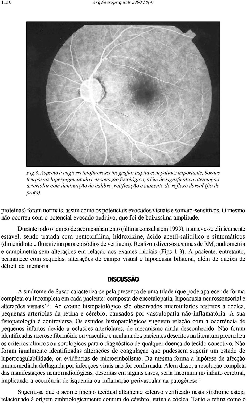 calibre, retificação e aumento do reflexo dorsal (fio de prata). proteínas) foram normais, assim como os potenciais evocados visuais e somato-sensitivos.