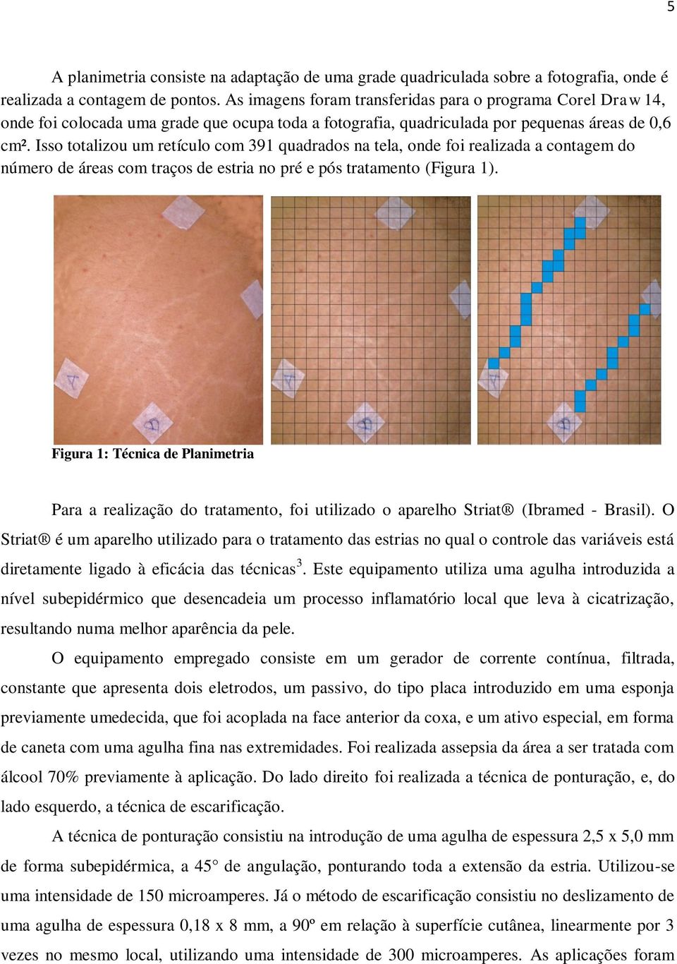 Isso totalizou um retículo com 391 quadrados na tela, onde foi realizada a contagem do número de áreas com traços de estria no pré e pós tratamento (Figura 1).