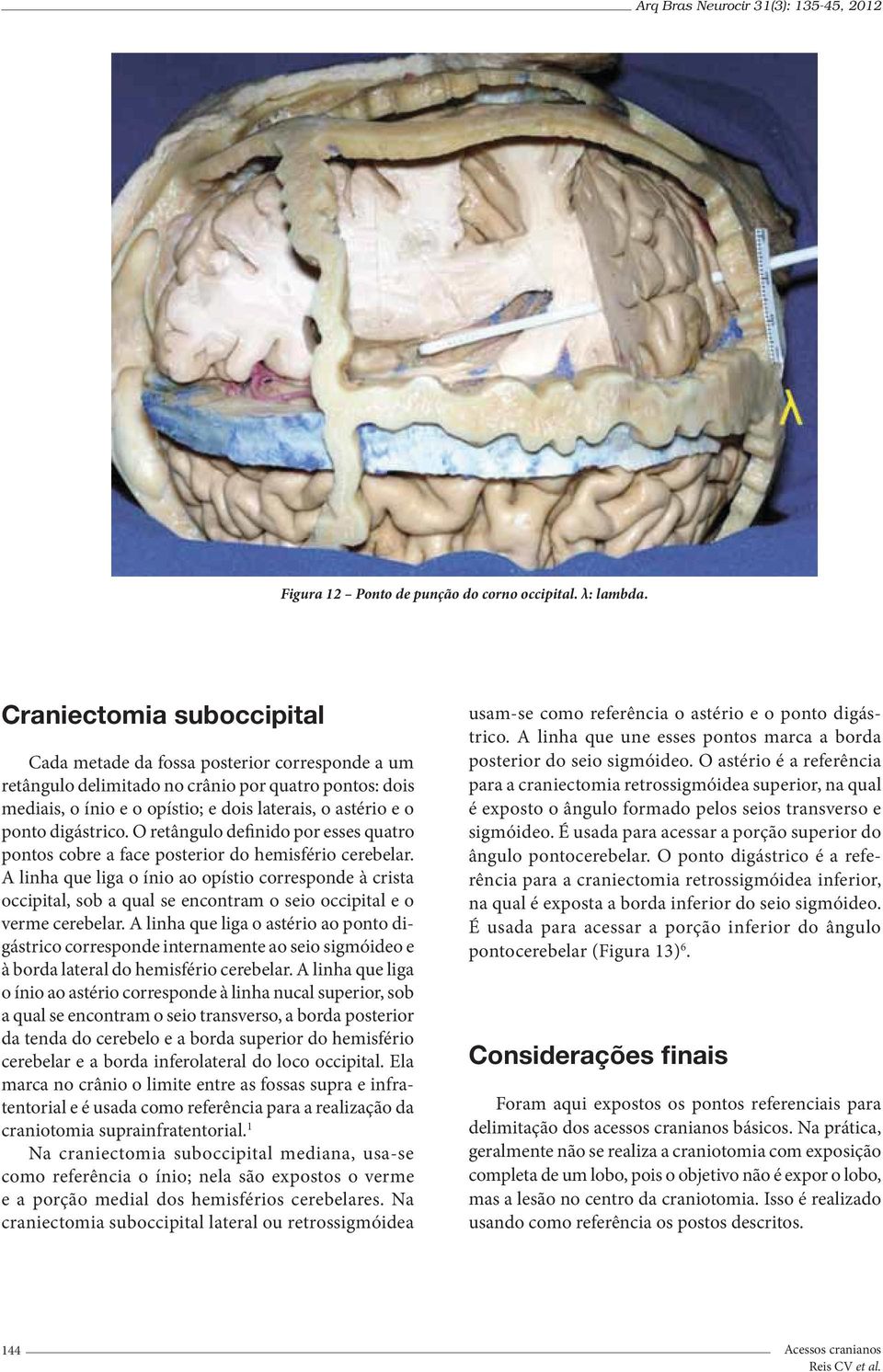 digástrico. O retângulo definido por esses quatro pontos cobre a face posterior do hemisfério cerebelar.