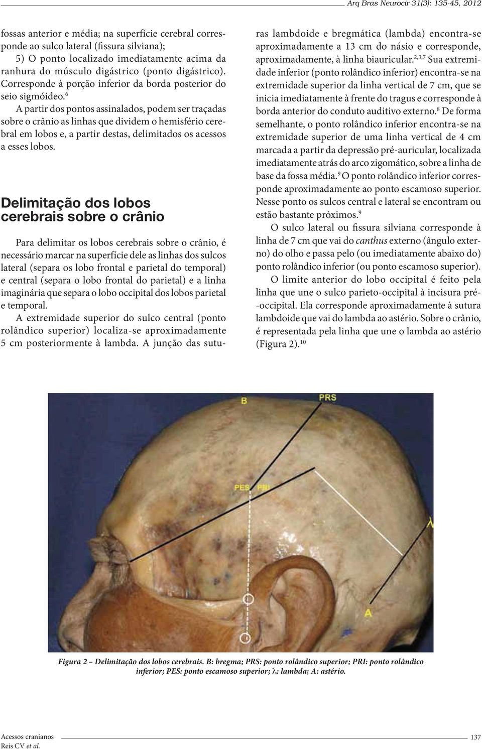 6 A partir dos pontos assinalados, podem ser traçadas sobre o crânio as linhas que dividem o hemisfério cerebral em lobos e, a partir destas, delimitados os acessos a esses lobos.