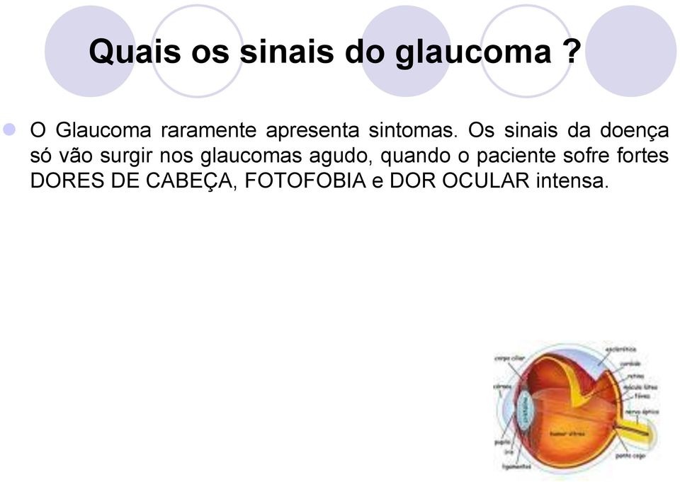 Os sinais da doença só vão surgir nos glaucomas