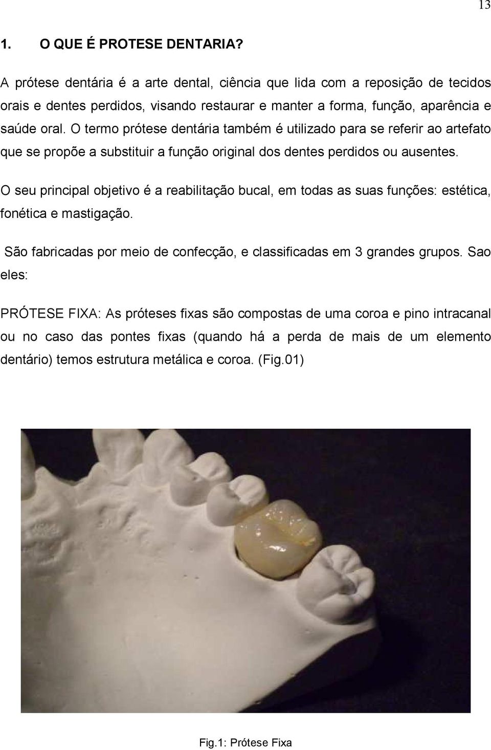 O termo prótese dentária também é utilizado para se referir ao artefato que se propõe a substituir a função original dos dentes perdidos ou ausentes.