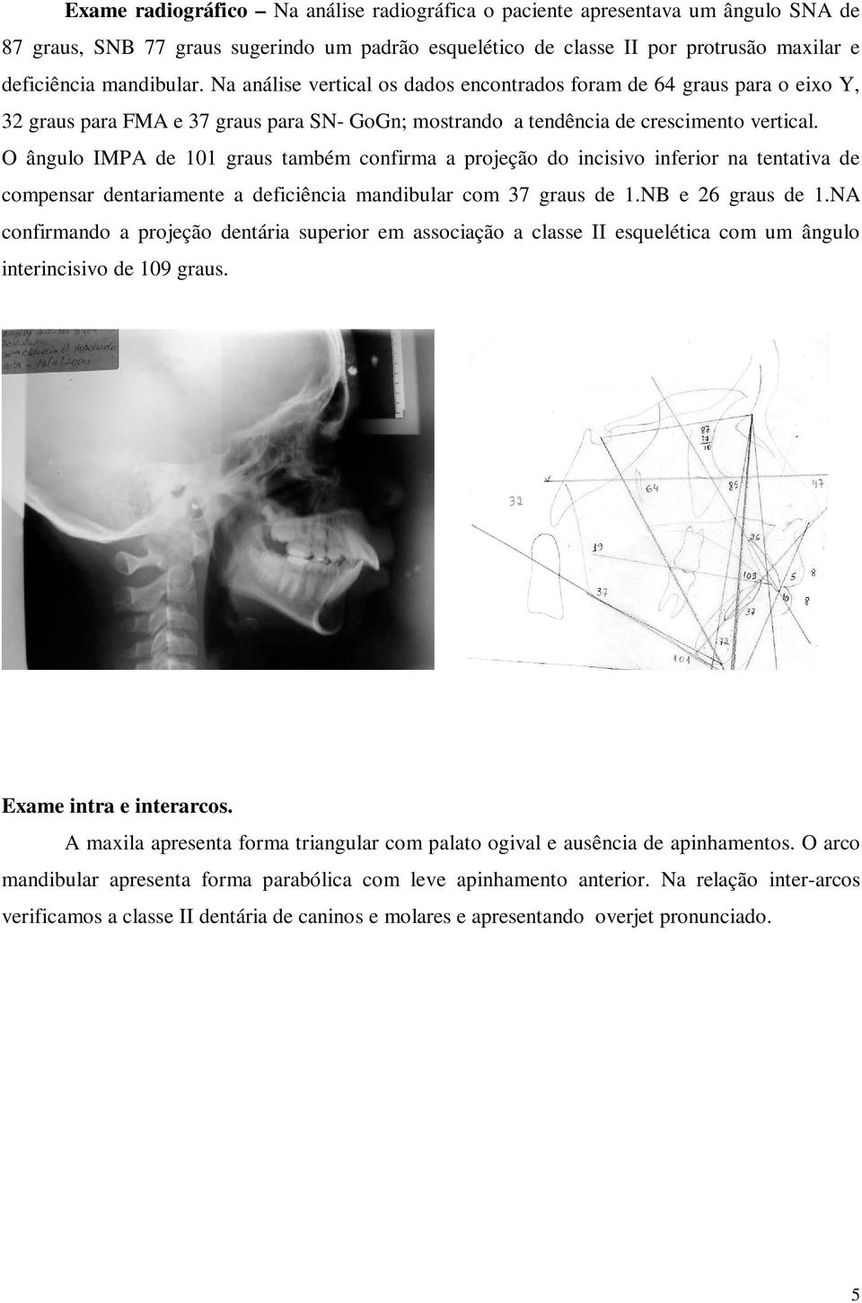 O ângulo IMPA de 101 graus também confirma a projeção do incisivo inferior na tentativa de compensar dentariamente a deficiência mandibular com 37 graus de 1.NB e 26 graus de 1.