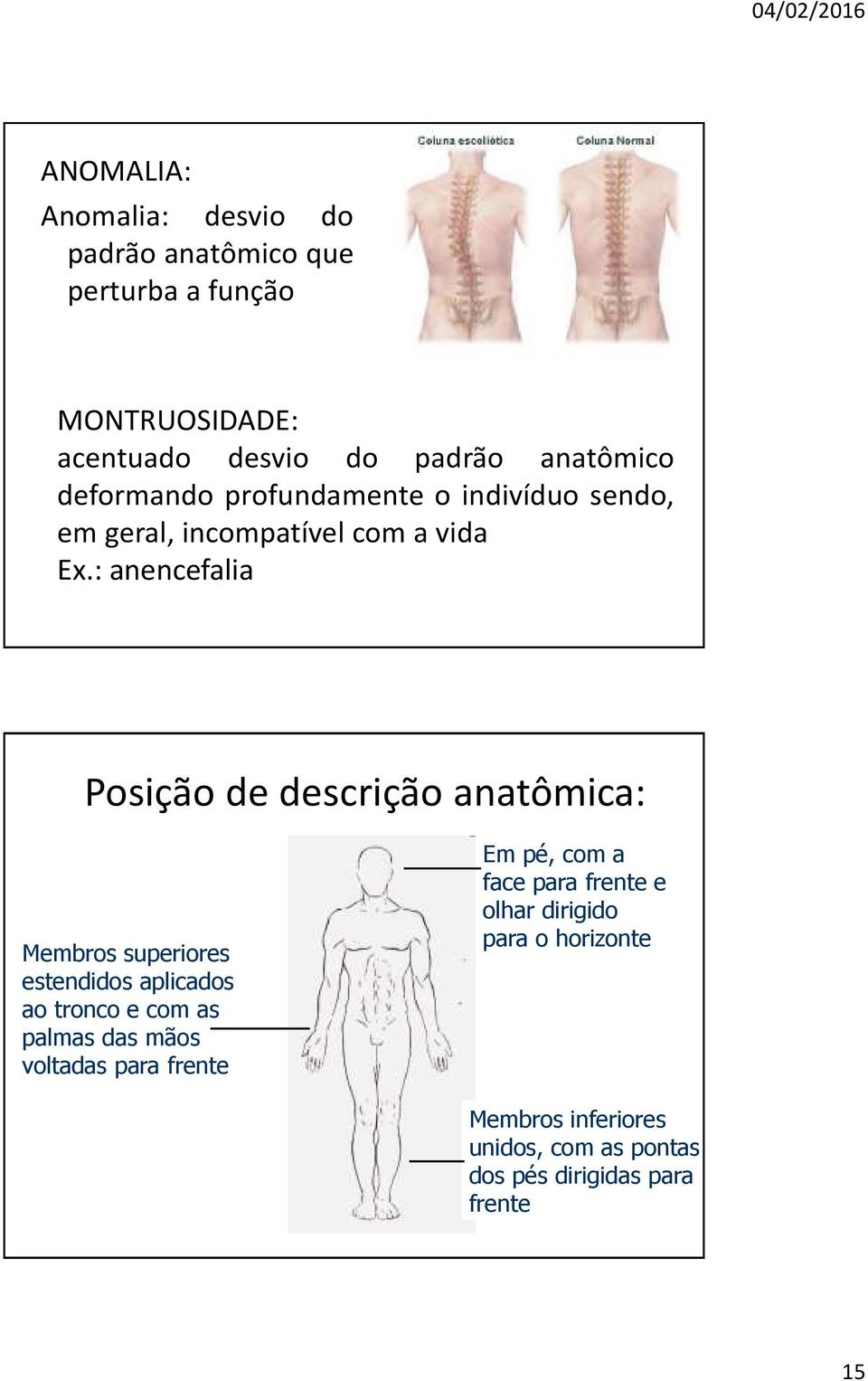 : anencefalia Posição de descrição anatômica: Membros superiores estendidos aplicados ao tronco e com as palmas das mãos