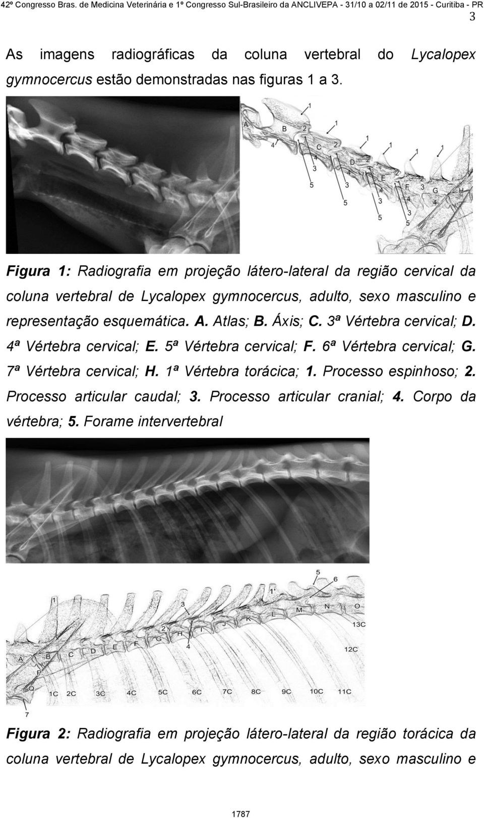 Áxis; C. 3ª Vértebra cervical; D. 4ª Vértebra cervical; E. 5ª Vértebra cervical; F. 6ª Vértebra cervical; G. 7ª Vértebra cervical; H. 1ª Vértebra torácica; 1.