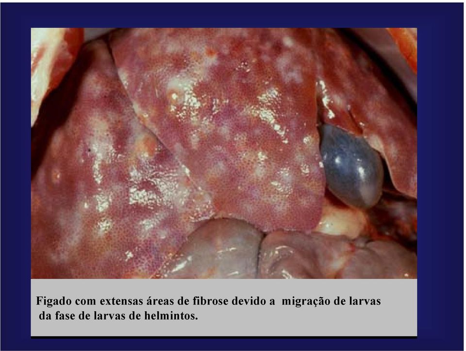 a migração de larvas da