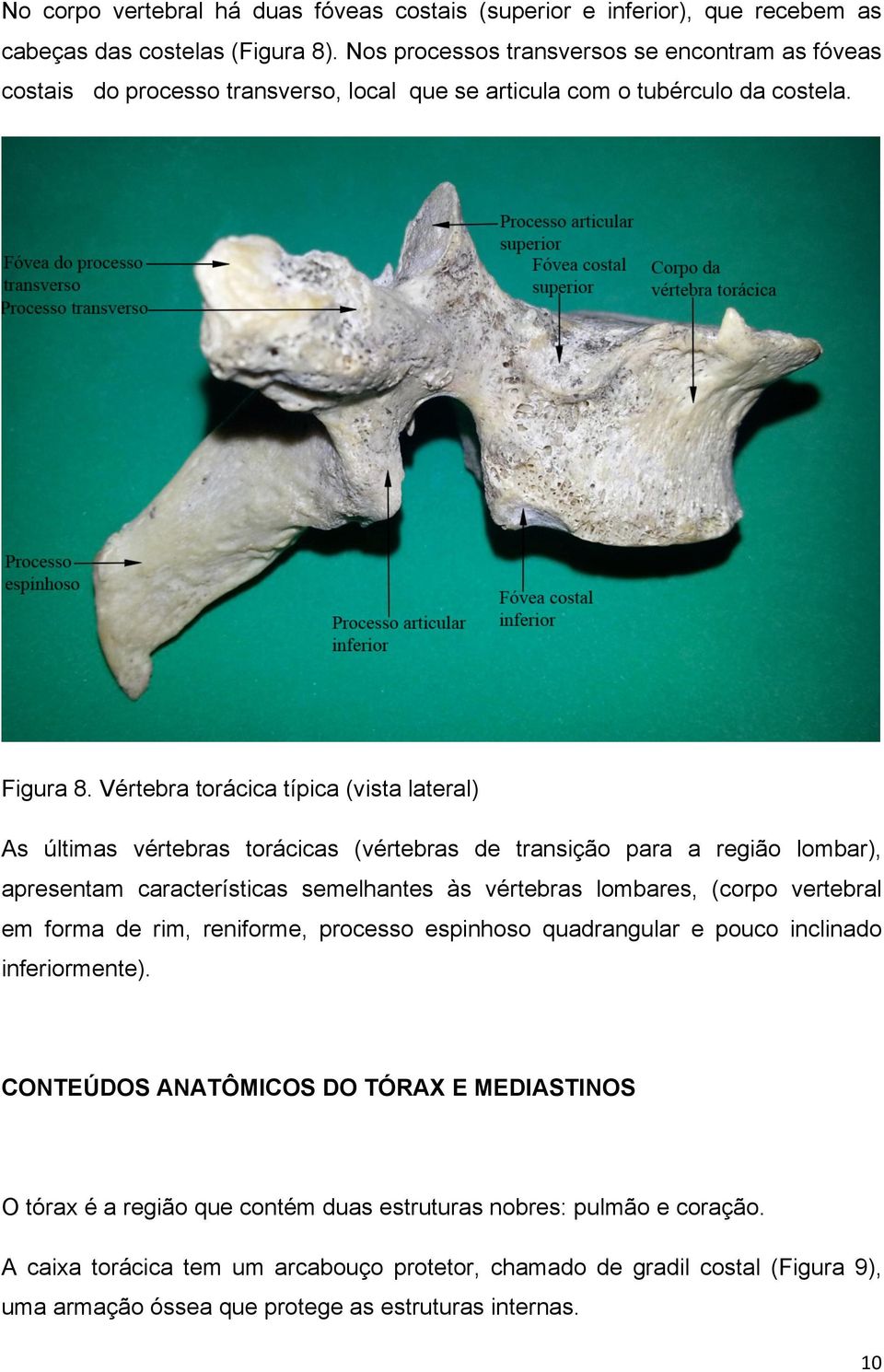 Vértebra torácica típica (vista lateral) As últimas vértebras torácicas (vértebras de transição para a região lombar), apresentam características semelhantes às vértebras lombares, (corpo vertebral