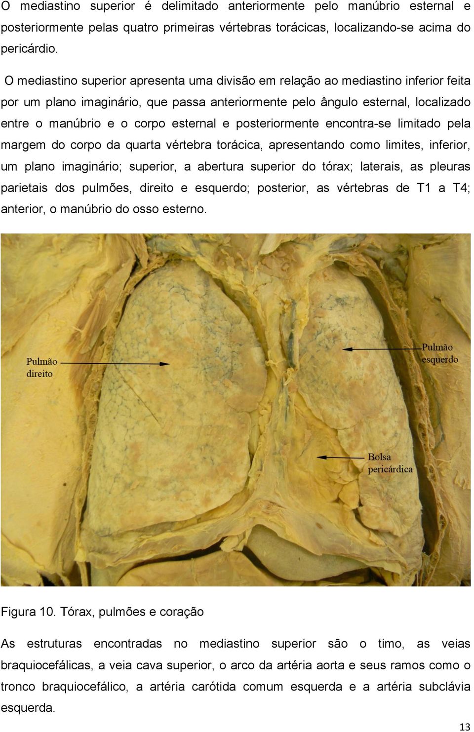 esternal e posteriormente encontra-se limitado pela margem do corpo da quarta vértebra torácica, apresentando como limites, inferior, um plano imaginário; superior, a abertura superior do tórax;