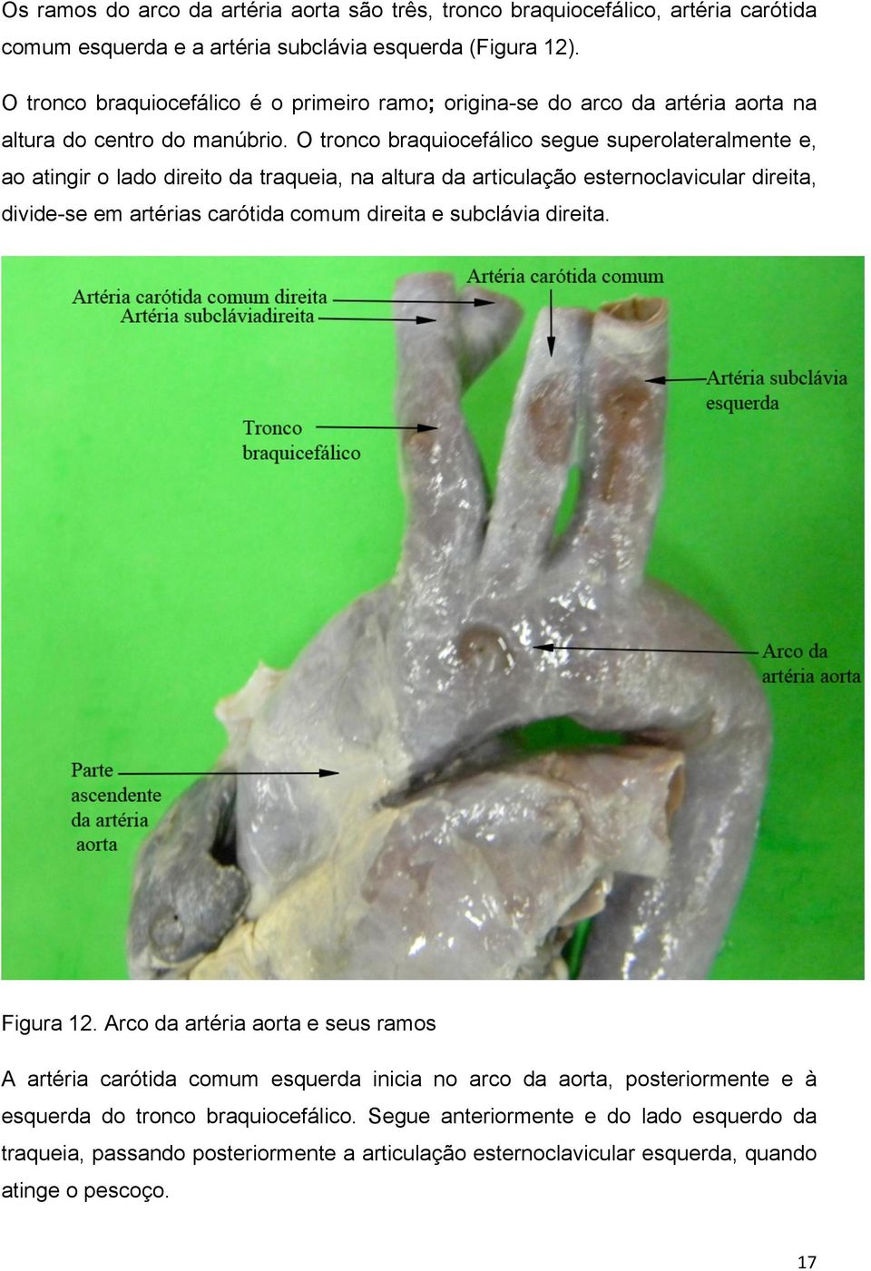 O tronco braquiocefálico segue superolateralmente e, ao atingir o lado direito da traqueia, na altura da articulação esternoclavicular direita, divide-se em artérias carótida comum direita e