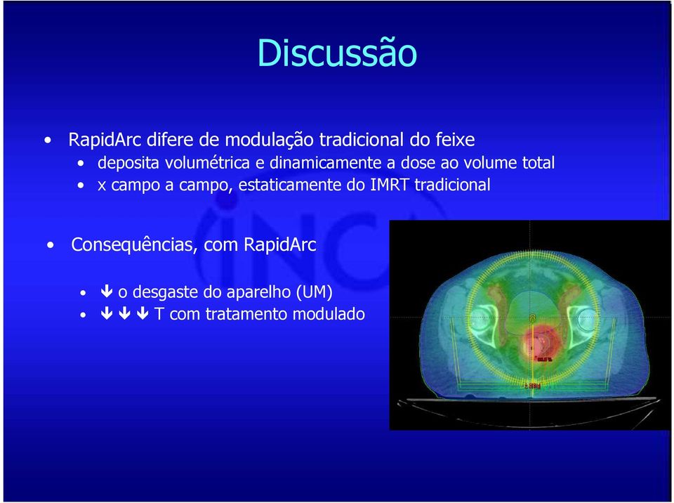 campo a campo, estaticamente do IMRT tradicional