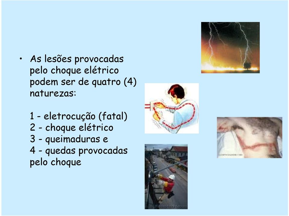 eletrocução (fatal) 2 - choque elétrico 3