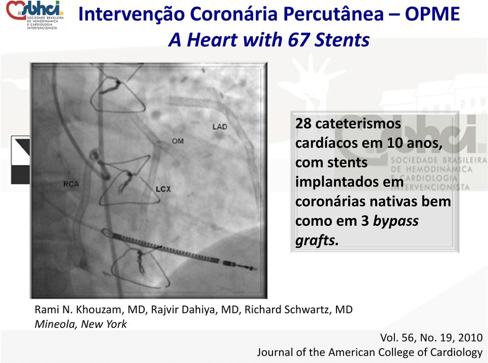 3 bypass grafts. Rami N.