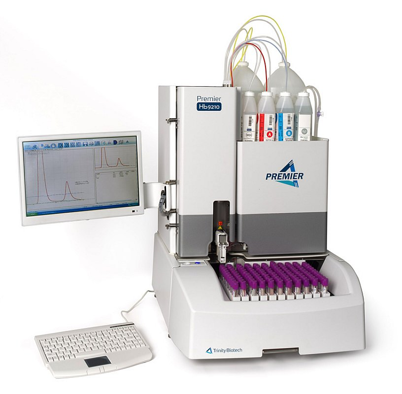 A vantagem do software Affinity Ao contrário da separação de carga baseado em HPLC de troca iónica, que não detecta todas as espécies de hemoglobinas glicadas (Hb), o Premier Hb9210 utiliza a ligação