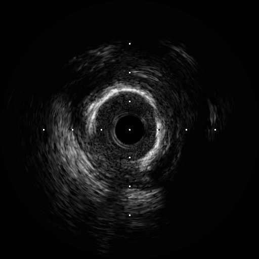 IVUS 270