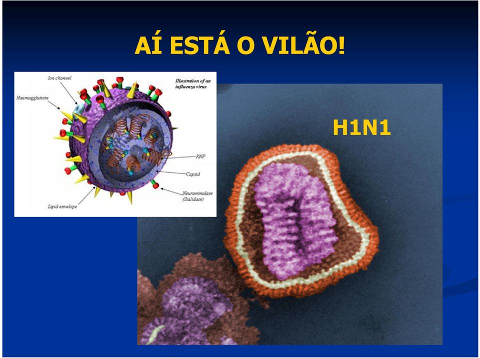 H1N1