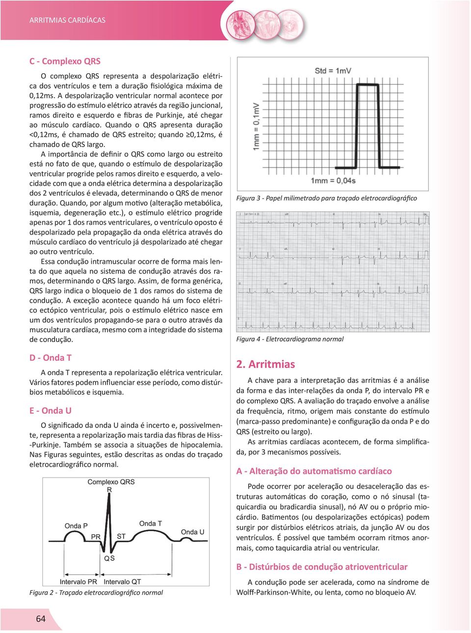 Quando o QRS apresenta duração <0,12ms, é chamado de QRS estreito; quando 0,12ms, é chamado de QRS largo.