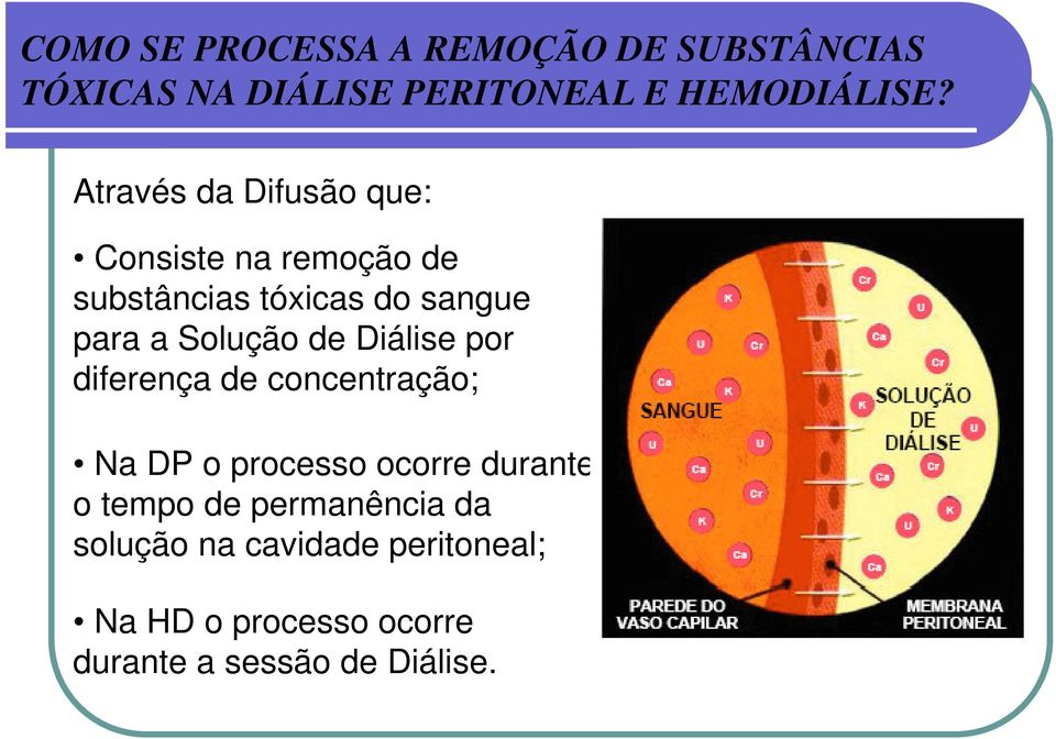 Solução de Diálise por diferença de concentração; Na DP o processo ocorre durante o tempo