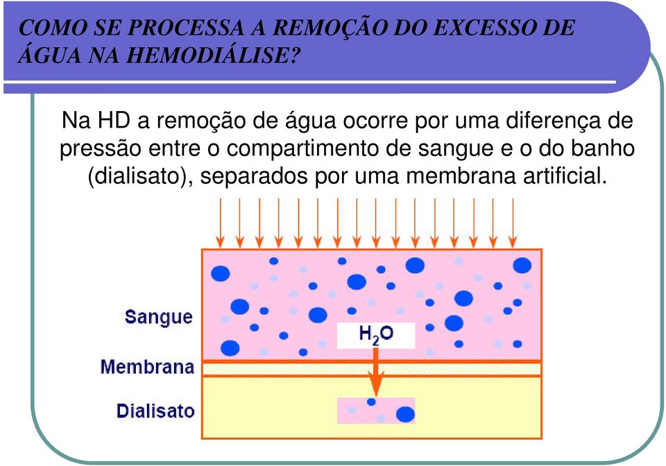 Na HD a remoção de água ocorre por uma diferença de