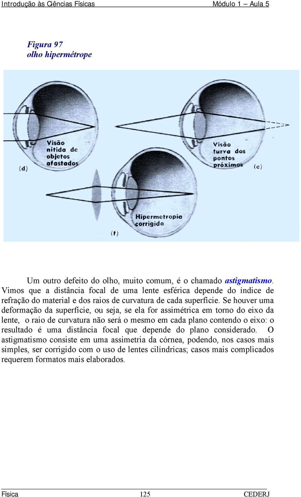 Se houver uma deformação da superfície, ou seja, se ela for assimétrica em torno do eixo da lente, o raio de curvatura não será o mesmo em cada plano contendo o eixo: o