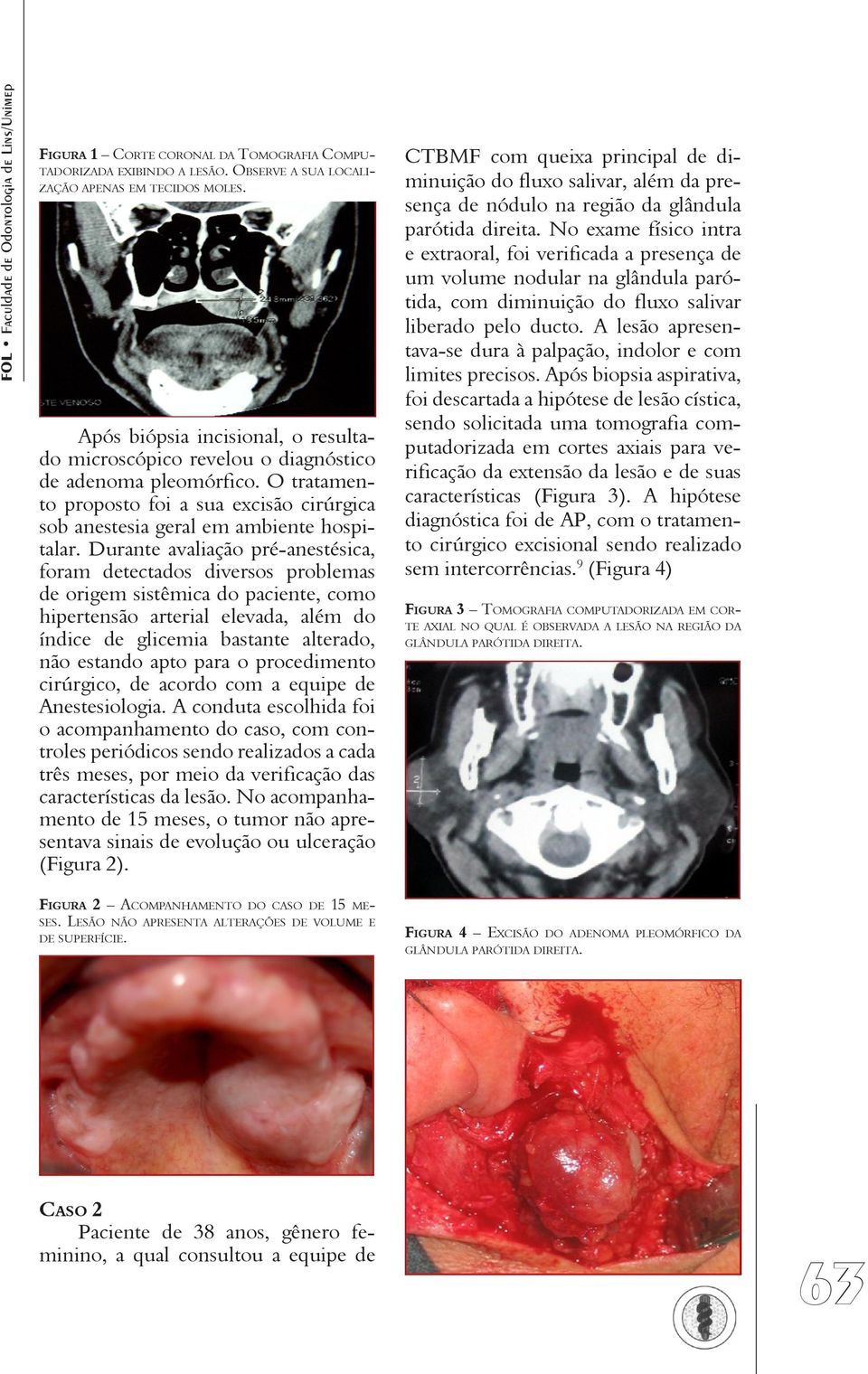 Durante avaliação pré-anestésica, foram detectados diversos problemas de origem sistêmica do paciente, como hipertensão arterial elevada, além do índice de glicemia bastante alterado, não estando