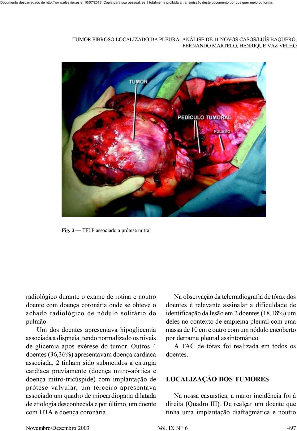 Outros 4 doentes (36,36%) apresentavam doença cardíaca associada, 2 tinham sido submetidos a cirurgia cardíaca previamente (doença mitro-aórtica e doença mitro-tricúspide) com implantação de prótese