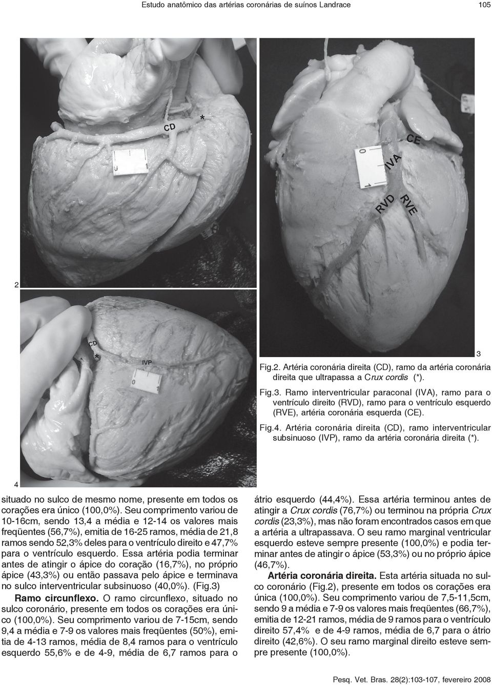 Ramo interventricular paraconal (IVA), ramo para o ventrículo direito (RVD), ramo para o ventrículo esquerdo (RVE), artéria coronária esquerda (CE). Fig.4.