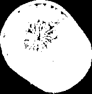 Testículo Período de maturação Período de diferenciação Meiose n n n n n n n n n n Espermatócito I (2n)