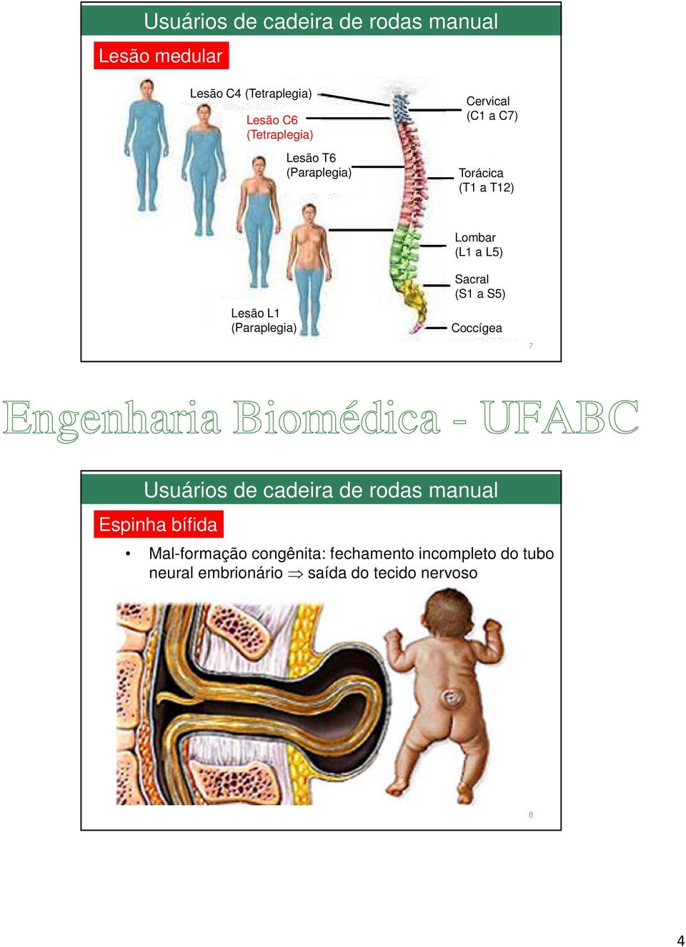 (Paraplegia) Lombar (L1 a L5) Sacral (S1 a S5) Coccígea 7 Usuários de cadeira de rodas manual