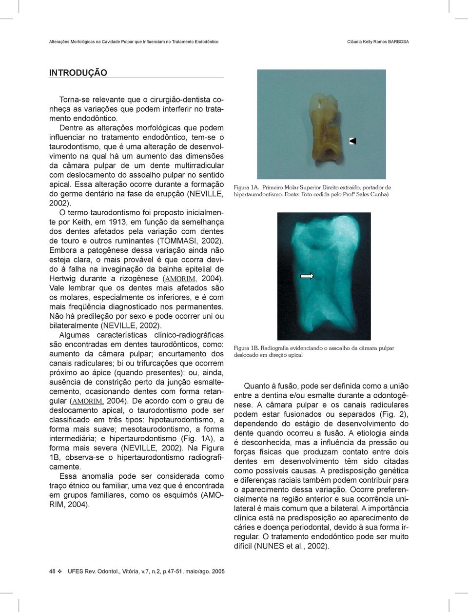 de um dente multirradicular com deslocamento do assoalho pulpar no sentido apical. Essa alteração ocorre durante a formação do germe dentário na fase de erupção (NEVILLE, 2002).