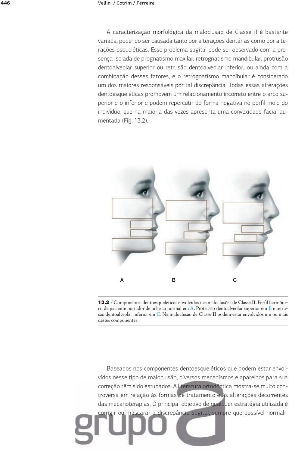 combinação desses fatores, e o retrognatismo mandibular é considerado um dos maiores responsáveis por tal discrepância.