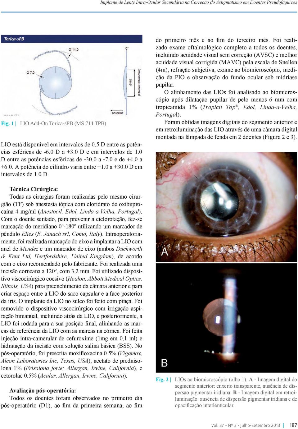 biomicroscópio, medição da PIO e observação do fundo ocular sob midríase pupilar.