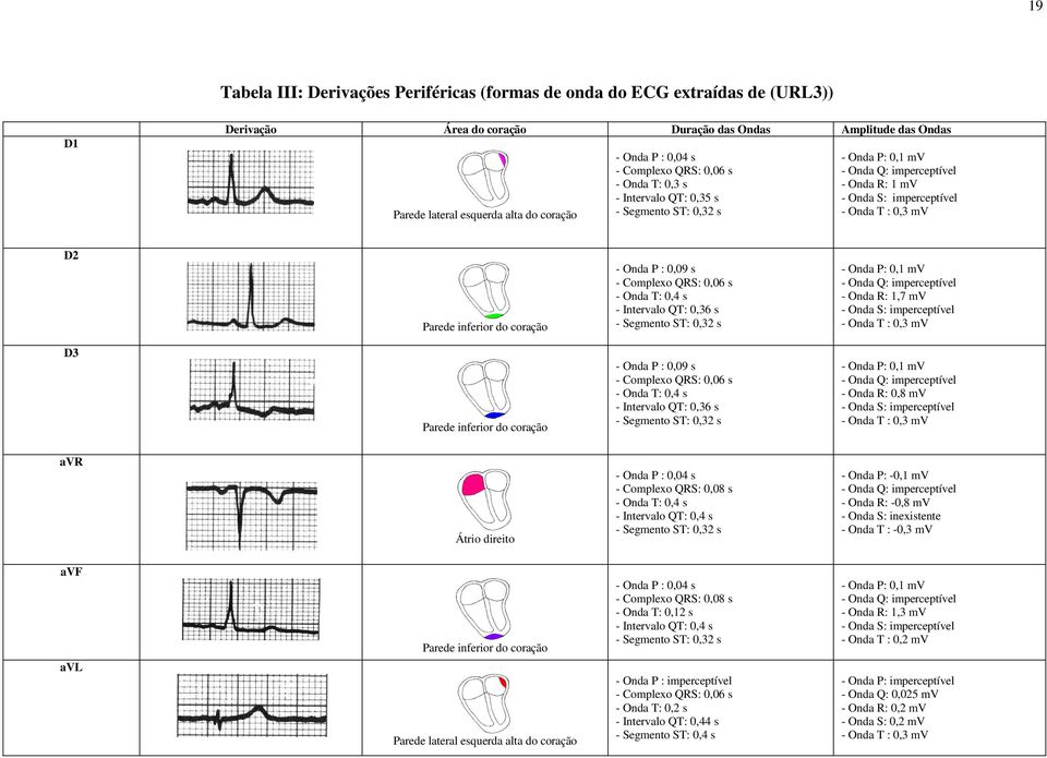 inferior do coração - Onda P : 0,09 s - Complexo QRS: 0,06 s - Onda T: 0,4 s - Intervalo QT: 0,36 s - Segmento ST: 0,32 s - Onda P: 0,1 mv - Onda Q: imperceptível - Onda R: 1,7 mv - Onda S: