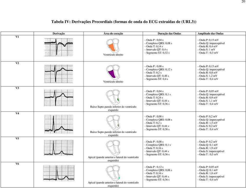 0,08 s - Complexo QRS: 0,12 s - Onda T: 0,2 s - Intervalo QT: 0,48 s - Segmento ST: 0,4 s - Onda P: 0,15 mv - Onda Q: imperceptível - Onda R: 0,8 mv - Onda S: 1,2 mv - Onda T : 0,4 mv V3 V4 V5 V6