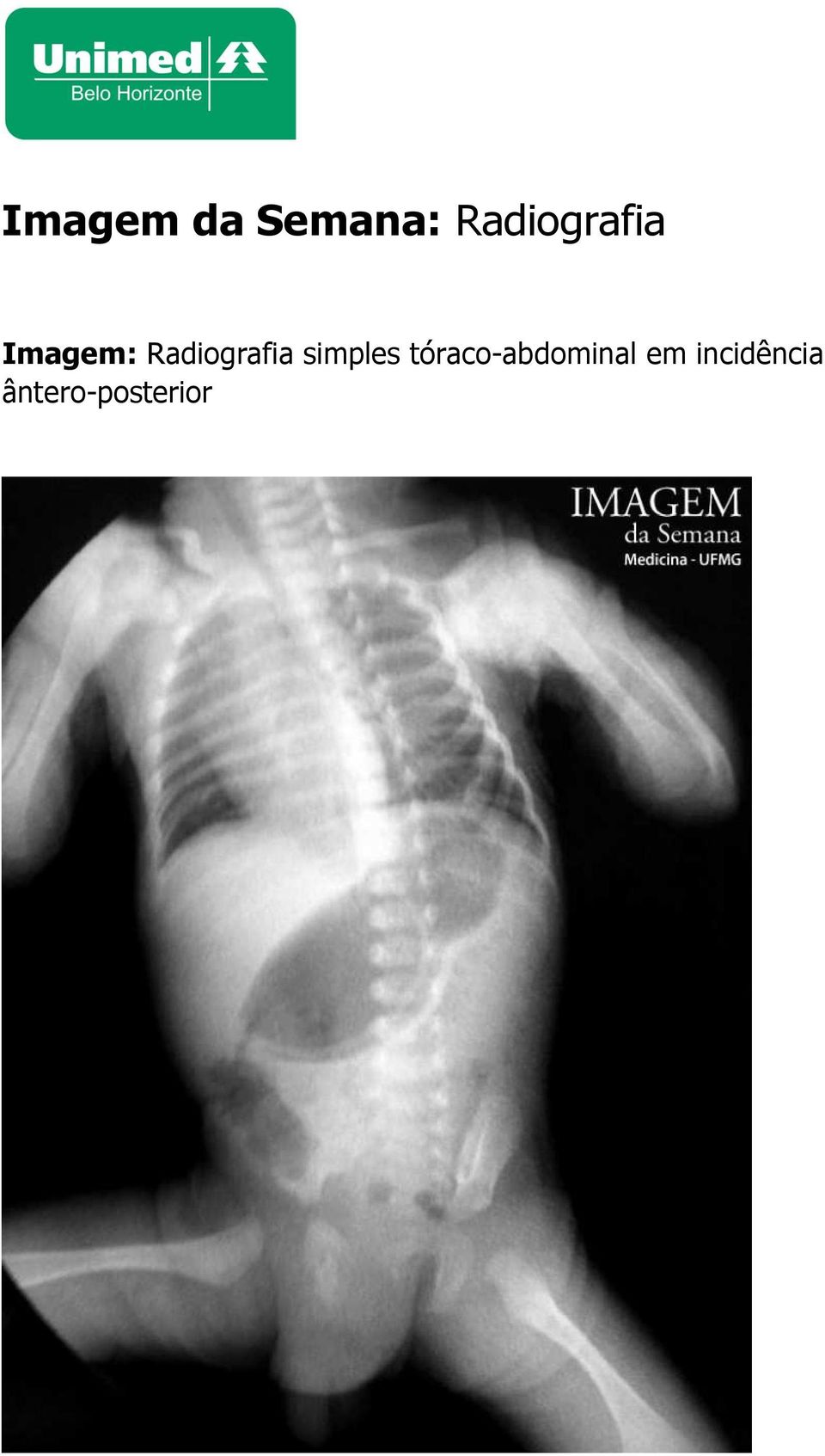 Radiografia simples