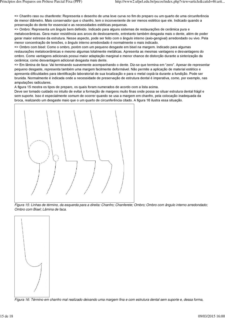 => Ombro: Representa um ângulo bem definido. Indicado para alguns sistemas de restaurações de cerâmica pura e metalocerâmicas.