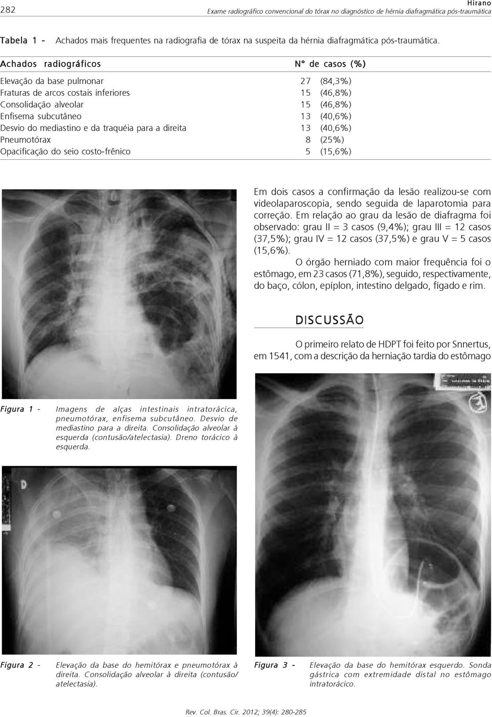 Achados radiográficos N de casos (%) Elevação da base pulmonar 27 (84,3%) Fraturas de arcos costais inferiores 15 (46,8%) Consolidação alveolar 15 (46,8%) Enfisema subcutâneo 13 (40,6%) Desvio do