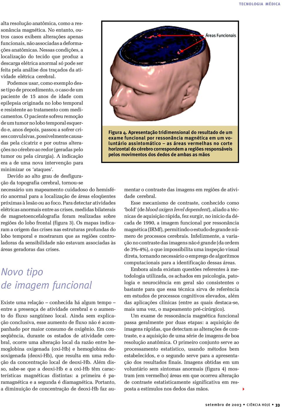 Podemos usar, como exemplo desse tipo de procedimento, o caso de um paciente de 15 anos de idade com epilepsia originada no lobo temporal e resistente ao tratamento com medicamentos.