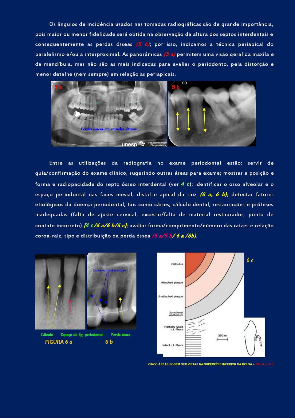 As panorâmicas (5 a) permitem uma visão geral da maxila e da mandíbula, mas não são as mais indicadas para avaliar o periodonto, pela distorção e menor detalhe (nem sempre) em relação às periapicais.