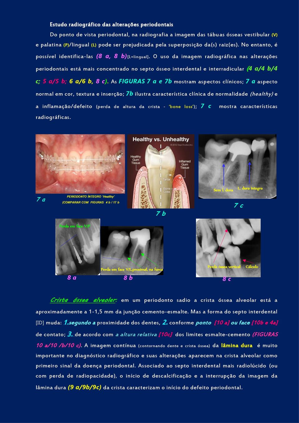 O uso da imagem radiográfica nas alterações periodontais está mais concentrado no septo ósseo interdental e interradicular (4 a/4 b/4 c; 5 a/5 b; 6 a/6 b, 8 c).