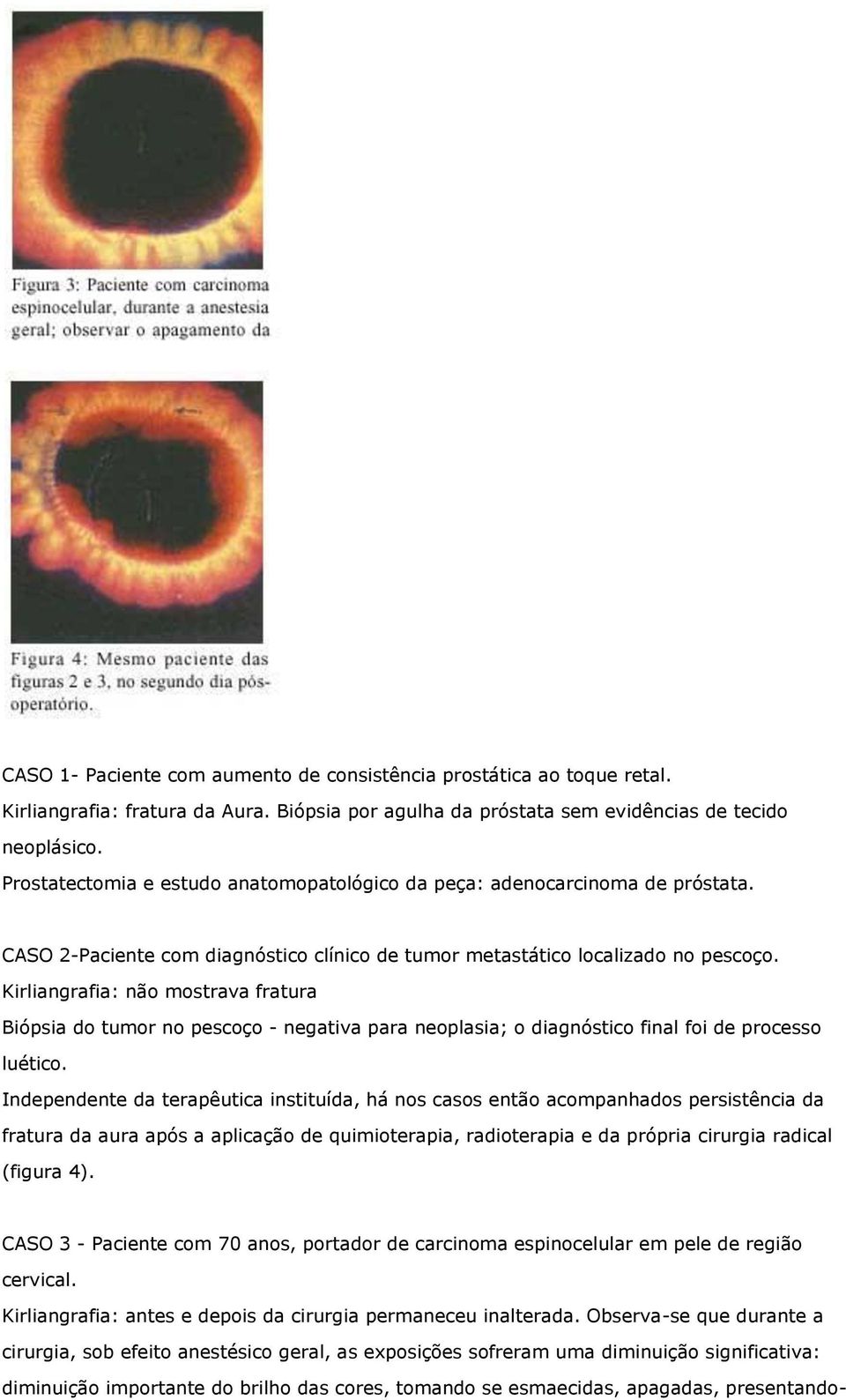 Kirliangrafia: não mostrava fratura Biópsia do tumor no pescoço - negativa para neoplasia; o diagnóstico final foi de processo luético.