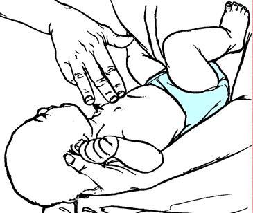 lactente, enquanto 1 ou 2 dedos da outra mão comprime o esterno (1/3 de sua profundidade). Compressões torácicas no lactente Realizar no mínimo 100 compressões por minuto.